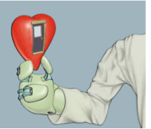 CULT Meeting 2017 Cardial intervention Under the Leaning Tower